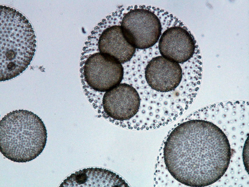 Investigación micológica