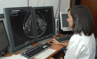 Una doctora estudia la mamografía de una paciente.