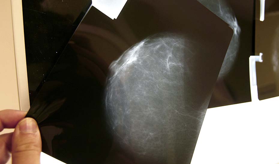Imagen de una mamografía. (Foto EFE)
