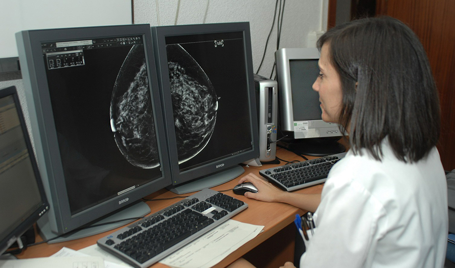 Una doctora observa una mamografía.